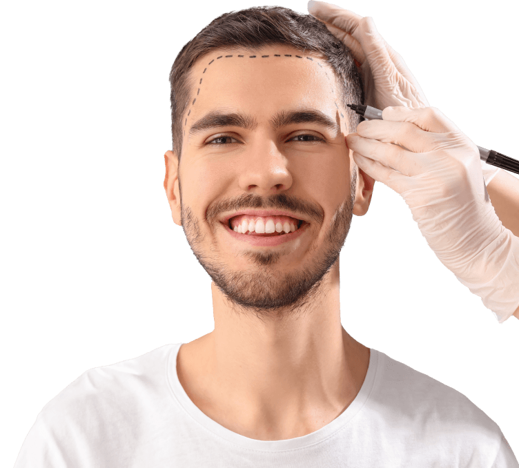 FUE Hair Transplant Procedure